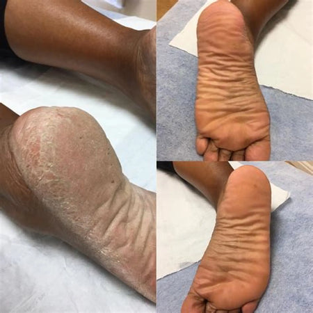 Râpe Électrique Anti-Callosités – Pour des pieds doux et lisses en un instant - Ma boutique